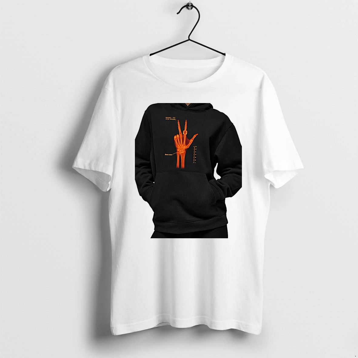 Officials Jalen Brunson Wears Requires Surgery X Ray Premium T Shirt Sweatshirt Hoodie